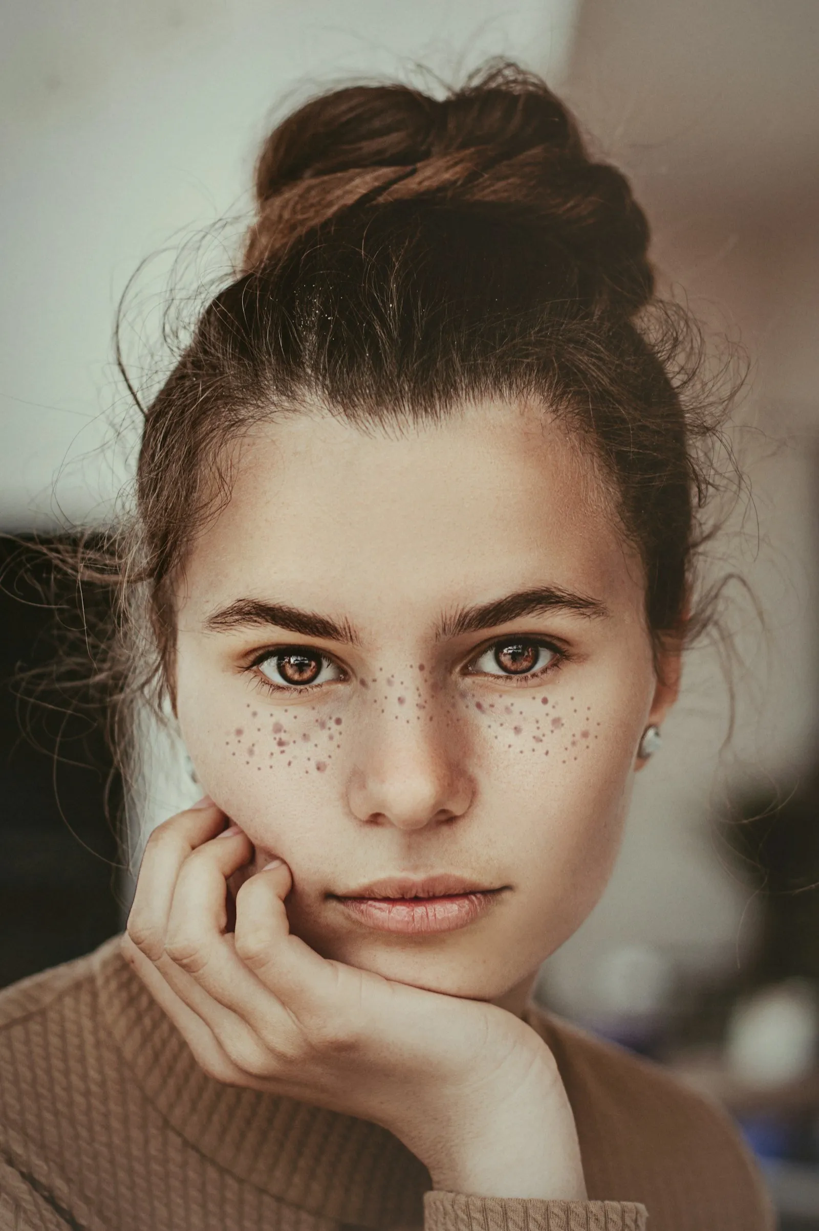 Young woman resting her chin on her hand, wearing drawn-on faux freckles across her nose and cheeks